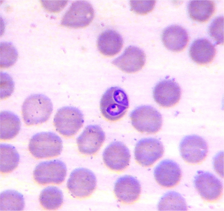 Blood smear showing Babesia parasites inside canine red blood cells