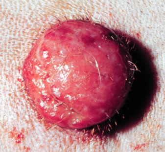 Raised pink skin lump (canine histiocytoma) on a dog