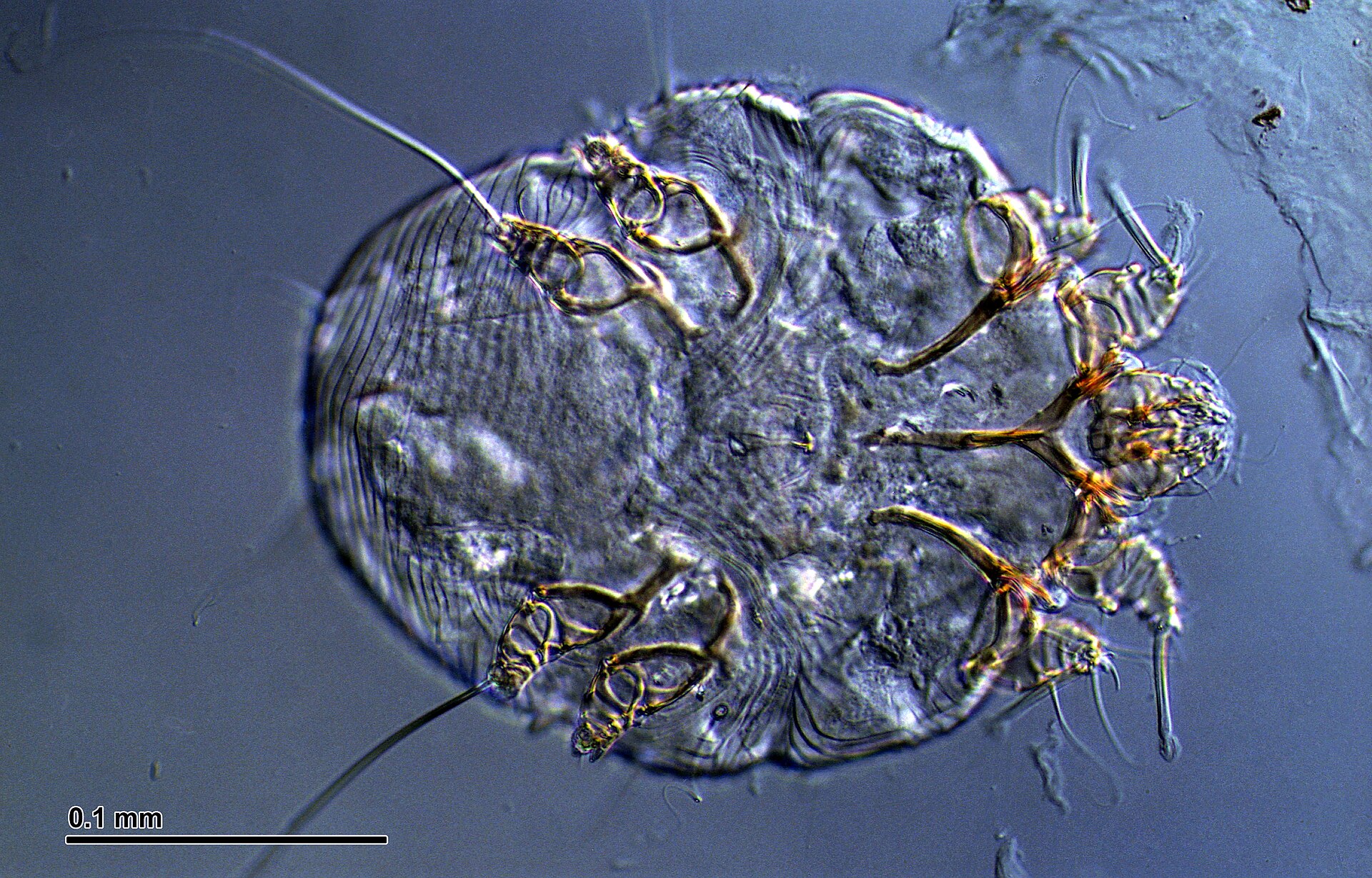 Light-microscope image of a Sarcoptes scabiei mite, the cause of sarcoptic mange