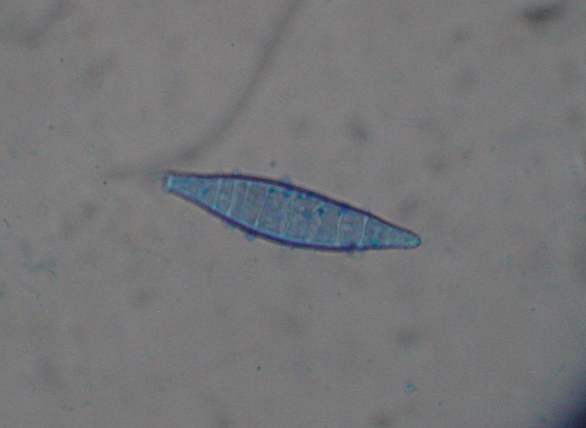 Circular area of hair loss caused by Microsporum canis (ringworm)